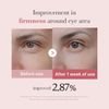 Medicube PDRN Pink Eye Cream 30ml - (1349)