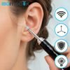 ISOMEDIX Otoscope - 14-piece set. - (19457-0)