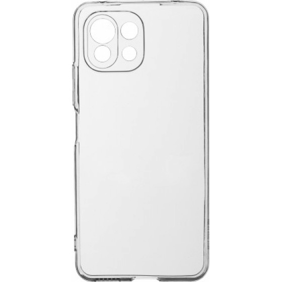Is Clear Tpu 2mm Xiaomi Mi 11 Lite Backcover - (CTPUXIAMI11L)
