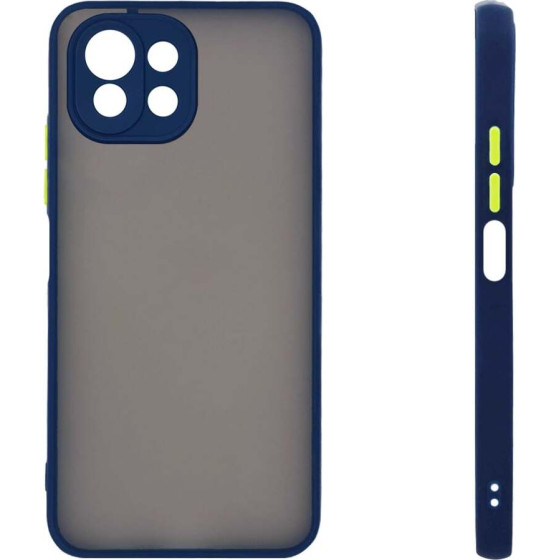 Sonique ���� ��������� Color Button Bumper Xiaomi Mi 11 Lite 4G / Mi 11 Lite 5G ���� - ���� - Mi 11 Lite 4G, Mi 11 Lite 5G