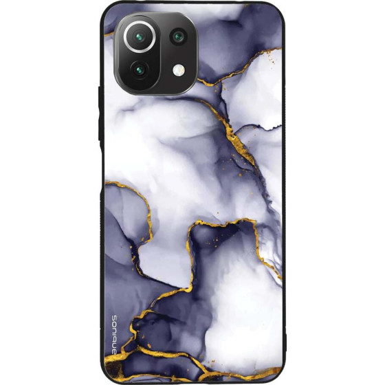 Sonique ���� Marble Series ��� Xiaomi Mi 11 Lite 4G / Mi 11 Lite 5G ��� ����