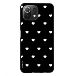 Sonique ���� Heart Series ��� Xiaomi Mi 11 Lite 4G / Mi 11 Lite 5G ����� 02