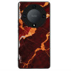 Sonique ���� Marble Series ��� Honor Magic5 Lite 5G �������