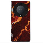 Sonique ���� Marble Series ��� Honor Magic5 Lite 5G �������