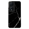 Sonique ���� Marble Series ��� Honor 90 Smart 5G / Honor X7b �����