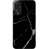 Sonique ���� Marble Series ��� Oppo A78 5G �����