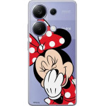 Disney Case Redmi Note 13 Pro Minnie Partial Print Smiley Transparent - (DPCMIN4169)