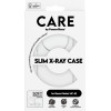 Care By PanzerGlass(R) Fashionable Case Transparent X-Ray Soft Basic Xiaomi Redmi 14C 4G - (PG-CRRFAXRG58421)