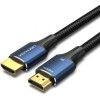 Vention 6.5mm Male To Male Audio Cable 1.5M Black - (BAABG)