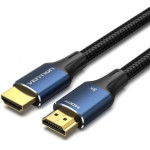 Vention 6.5mm Male To Male Audio Cable 1.5M Black - (BAABG)
