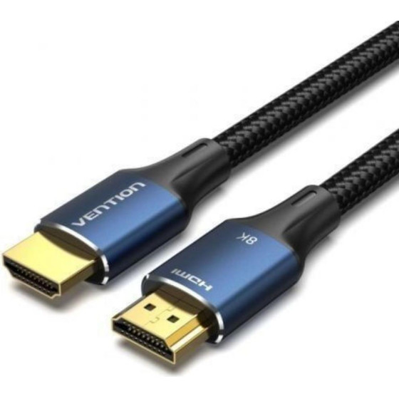 Vention 6.5mm Male To Male Audio Cable 1.5M Black - (BAABG)