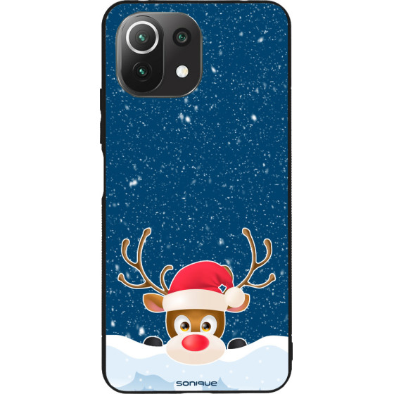 Sonique ���� Christmas Series ��� Xiaomi Mi 11 Lite 4G / Mi 11 Lite 5G Reindeer