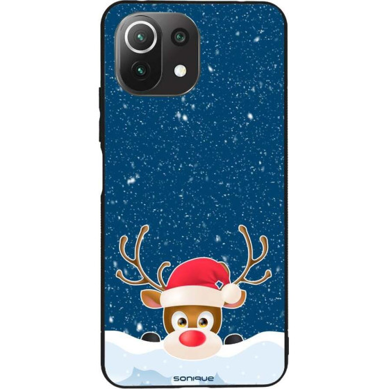 Sonique ���� Christmas Series ��� Xiaomi Mi 11 Lite 4G / Mi 11 Lite 5G Reindeer
