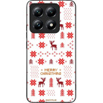 Sonique ���� Christmas Series ��� Xiaomi Xiaomi 14T Ugly Knit