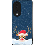 Sonique ���� Christmas Series ��� Honor 70 5G Reindeer