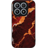 Sonique ���� Marble Series ��� Xiaomi Xiaomi 17 5G �������