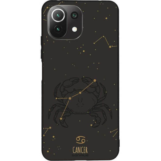 Sonique ���� Zodiac Series ��� Xiaomi Mi 11 Lite 4G / Mi 11 Lite 5G Cancer