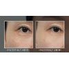 Dr. Melaxin Facephalt Tightening Cream - ������������� ����� ������ �������� - (DRM-04)