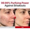 Purito Hypochlorous Acid Rescue Spray - ����������� & ������������� Mist �� Hocl & Witch Hazel - (PUR-18)