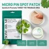 Some By Mi 30 Days Miracle Micro Pin Spot Patches - (SBM-29)