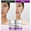 Vt Cosmetics Reedle Shot Lifting Cream - ����� �������� & ������������ - (VTC-27)