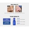 Medicube One Day Exosome Shot Pore Ampoule 2000 - ���� ���������� ��� ����� ��� ������� ����� - (MEDC-17)