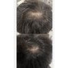 Medicube Soyxidil Shampoo - �������� ���� ��� ����������� - (MEDC-52)
