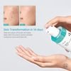 Anua Bha 2% Gentle Exfoliating Toner - (ANU-14)